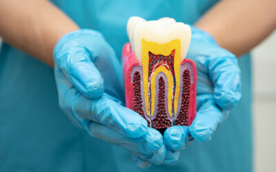 What a Root Canal Taught Me About Business